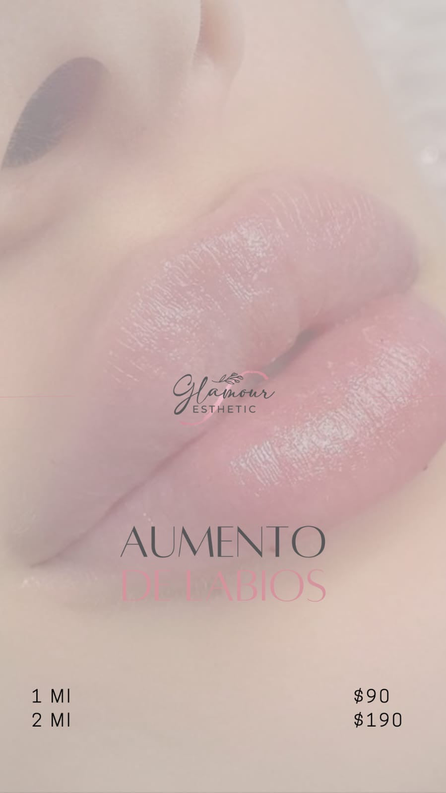 Aumento de labios